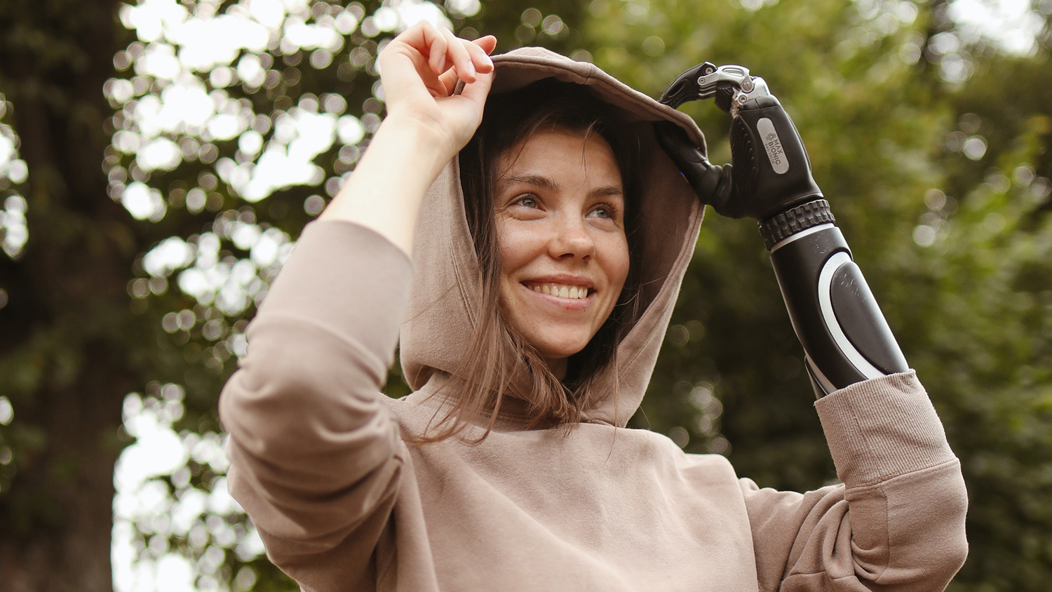 Žena s protézou na paži – pojištění pracovní neschopnosti